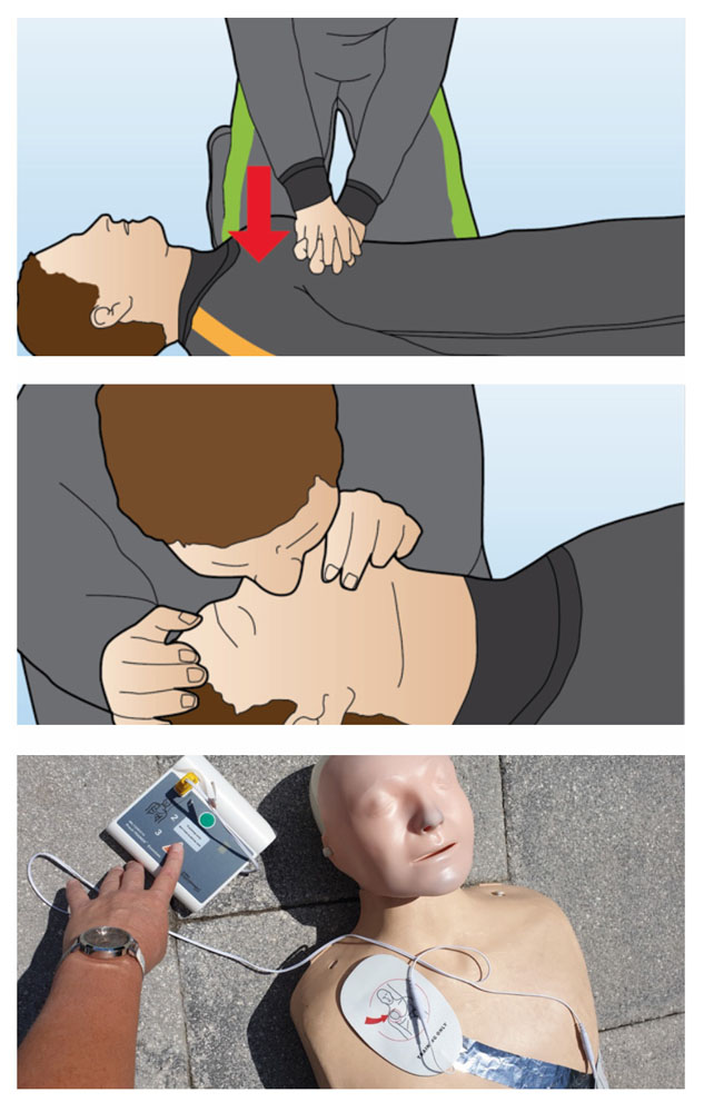 procedure