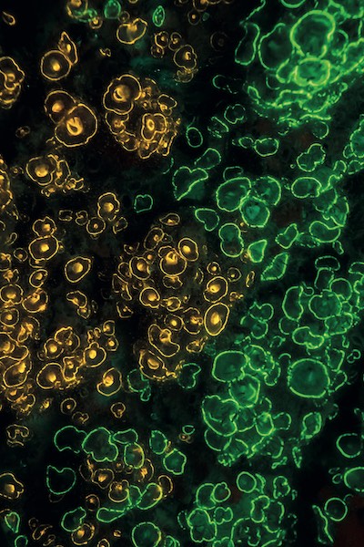 Anemones under fluorescent light